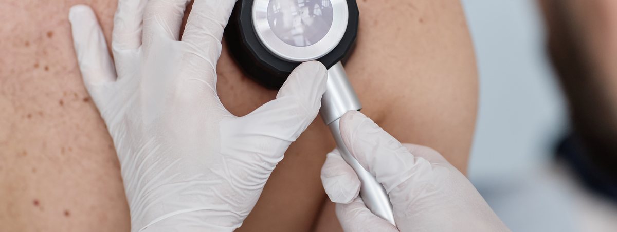 Prevención Dermatológica: Estudio de la Piel